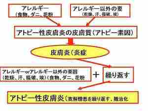 アトピー性皮膚炎は素因を持つ人に発症します。