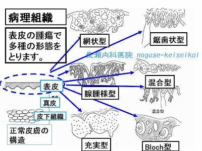 病理組織