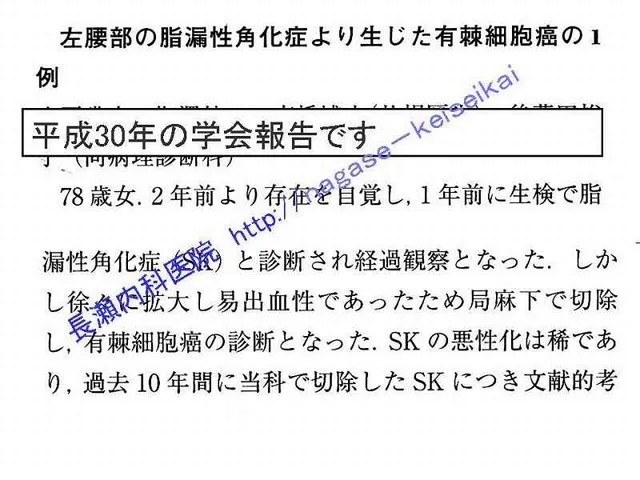 左腰部の脂漏性角化症により生じた有棘細胞癌の1例